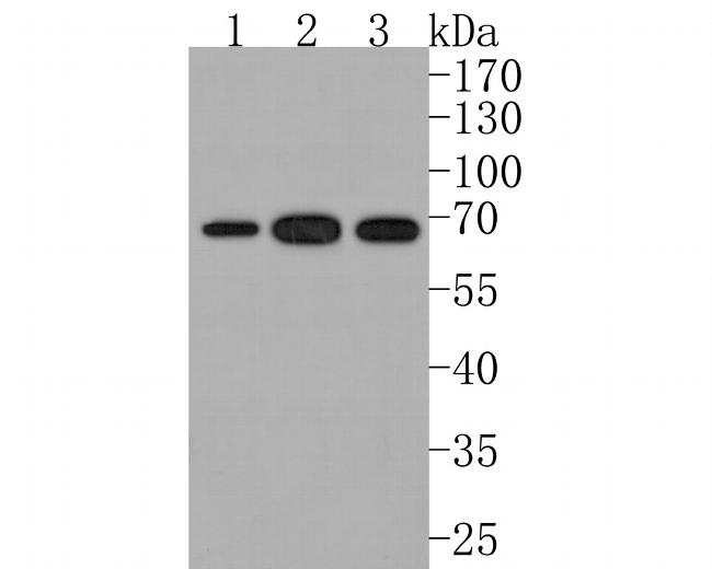 CLPX Antibody in Western Blot (WB)