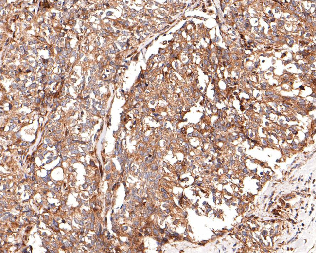 RAB5C Antibody in Immunohistochemistry (Paraffin) (IHC (P))