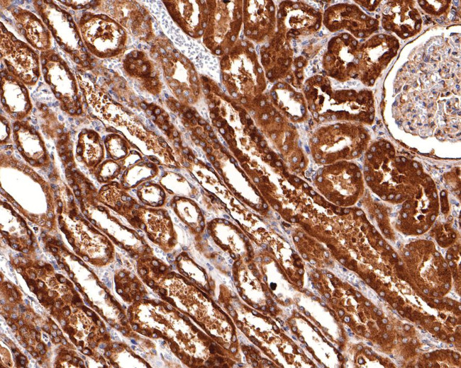 RAB5C Antibody in Immunohistochemistry (Paraffin) (IHC (P))