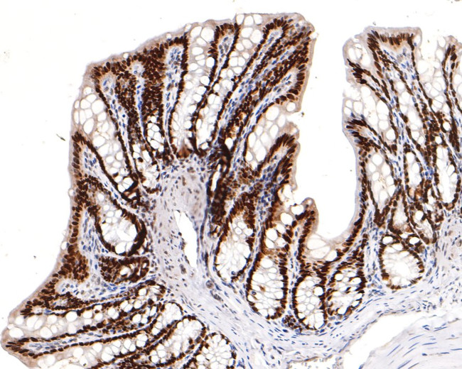 HNF4A Antibody in Immunohistochemistry (Paraffin) (IHC (P))