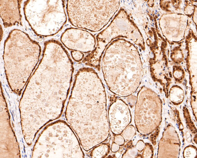 UBE2L3 Antibody in Immunohistochemistry (Paraffin) (IHC (P))