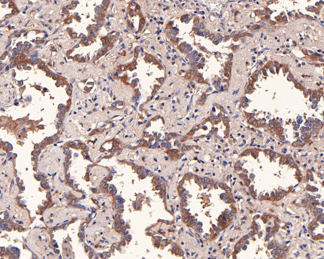 CTPS Antibody in Immunohistochemistry (Paraffin) (IHC (P))