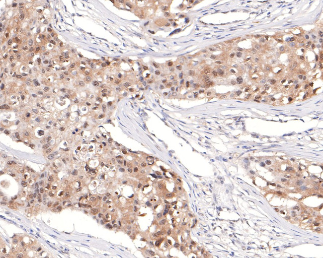 TCEB2 Antibody in Immunohistochemistry (Paraffin) (IHC (P))