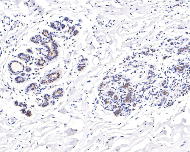 TCEB2 Antibody in Immunohistochemistry (Paraffin) (IHC (P))