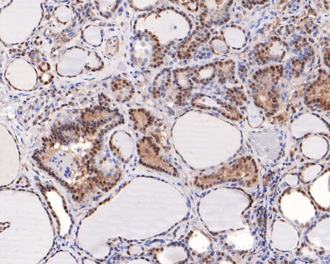 TCEB2 Antibody in Immunohistochemistry (Paraffin) (IHC (P))