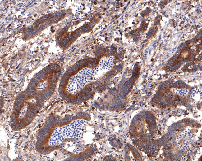 BIN1 Antibody in Immunohistochemistry (Paraffin) (IHC (P))