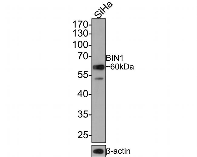 BIN1 Antibody in Western Blot (WB)