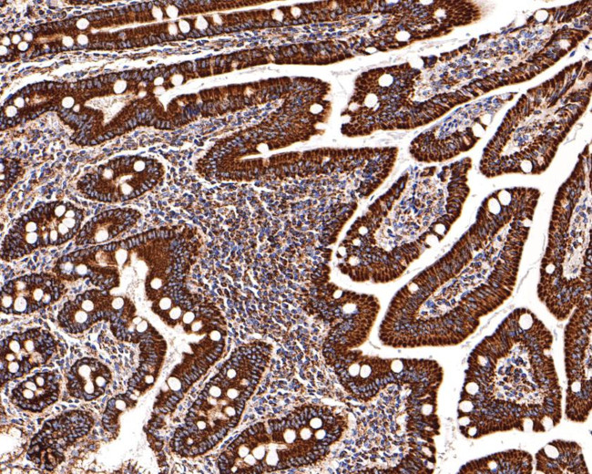 UQCRH Antibody in Immunohistochemistry (Paraffin) (IHC (P))