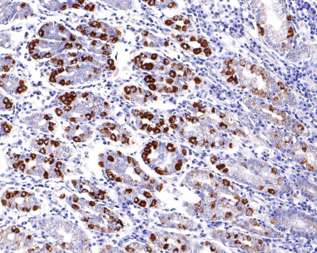 UQCRH Antibody in Immunohistochemistry (Paraffin) (IHC (P))