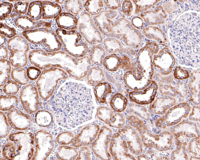 MUT Antibody in Immunohistochemistry (Paraffin) (IHC (P))