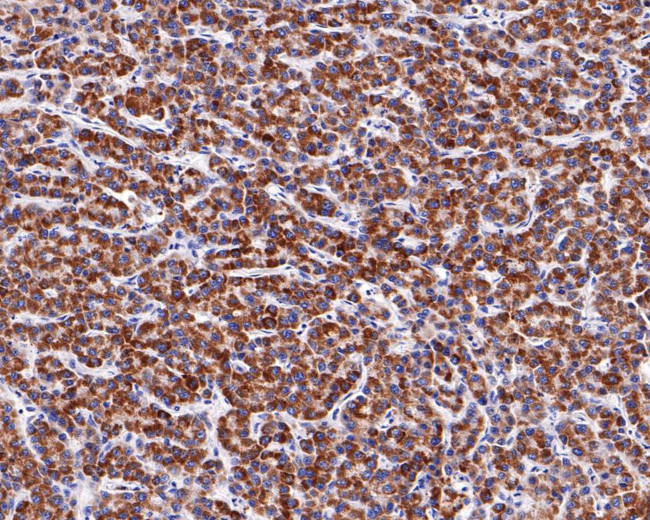 MUT Antibody in Immunohistochemistry (Paraffin) (IHC (P))