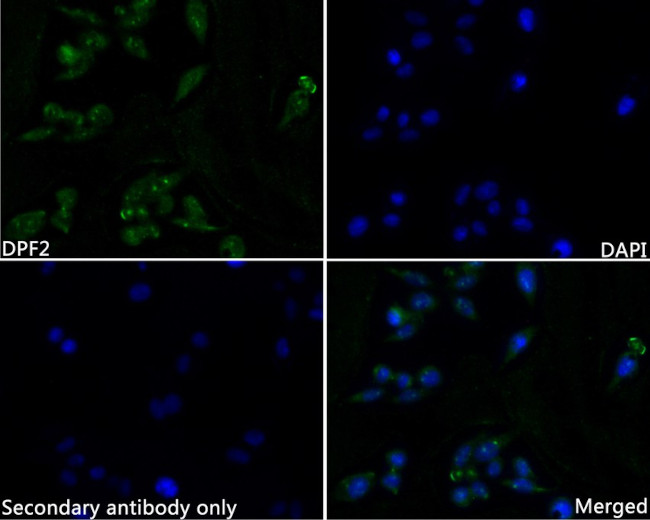 DPF2 Antibody in Immunocytochemistry (ICC/IF)