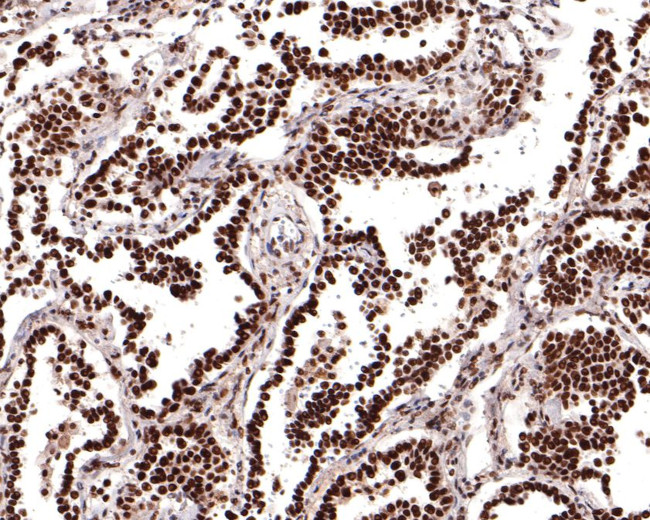 DPF2 Antibody in Immunohistochemistry (Paraffin) (IHC (P))