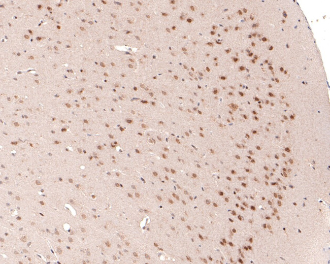 DPF2 Antibody in Immunohistochemistry (Paraffin) (IHC (P))