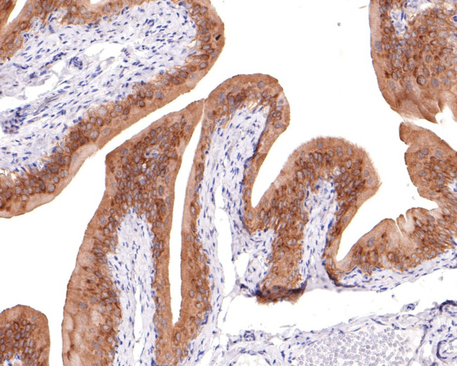 PKN2 Antibody in Immunohistochemistry (Paraffin) (IHC (P))