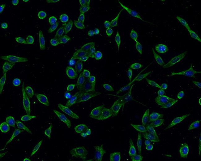 alpha-1a Adrenergic Receptor Antibody in Immunocytochemistry (ICC/IF)