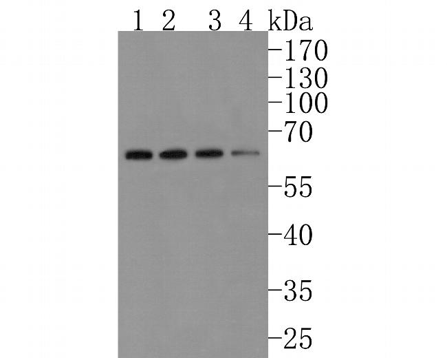 alpha-1a Adrenergic Receptor Antibody in Western Blot (WB)