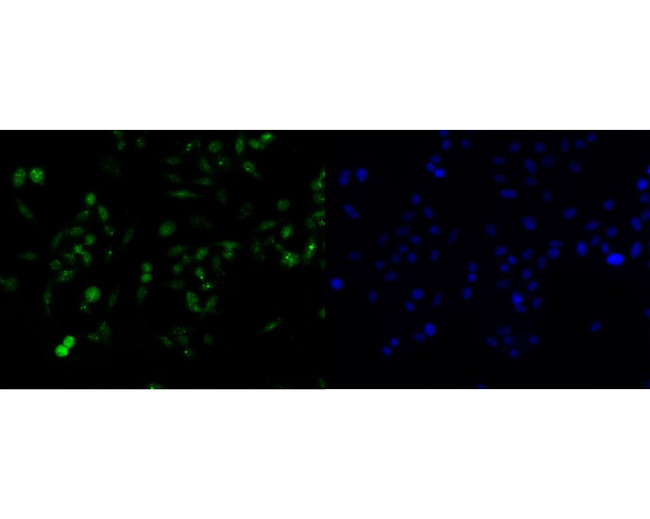 ABRA1 Antibody in Immunocytochemistry (ICC/IF)