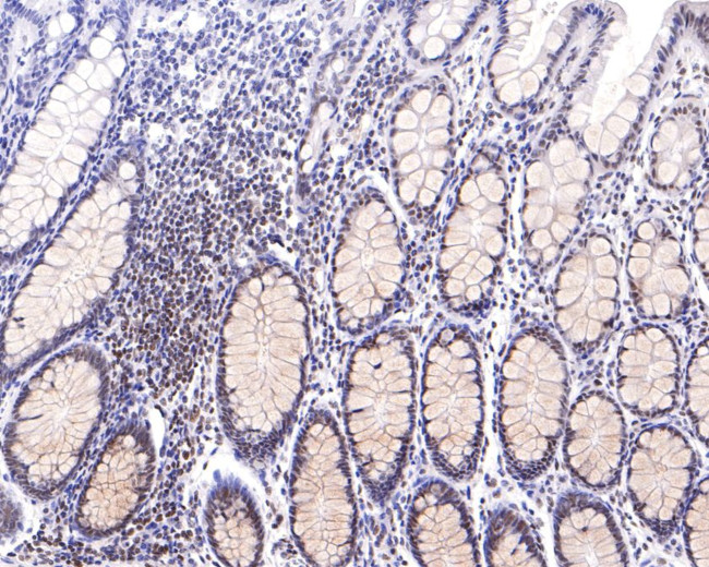 ABRA1 Antibody in Immunohistochemistry (Paraffin) (IHC (P))