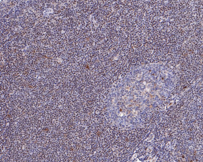 ABRA1 Antibody in Immunohistochemistry (Paraffin) (IHC (P))