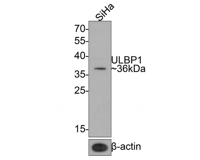 ULBP1 Antibody in Western Blot (WB)