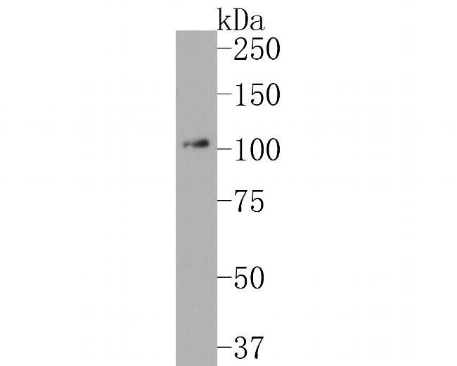 RIG-I Antibody in Western Blot (WB)