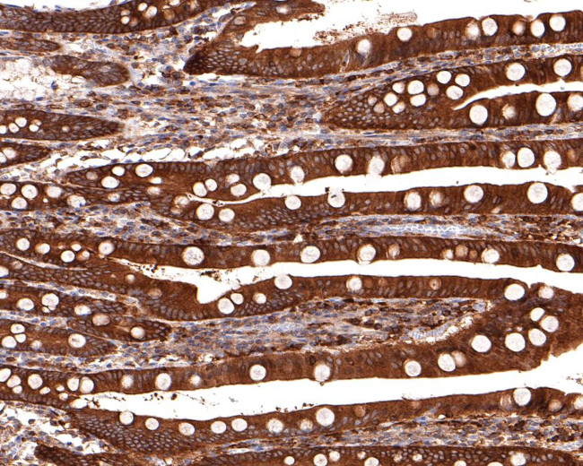 NMI Antibody in Immunohistochemistry (Paraffin) (IHC (P))