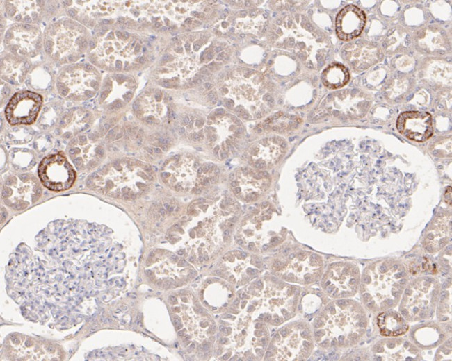 HMGCS2 Antibody in Immunohistochemistry (Paraffin) (IHC (P))