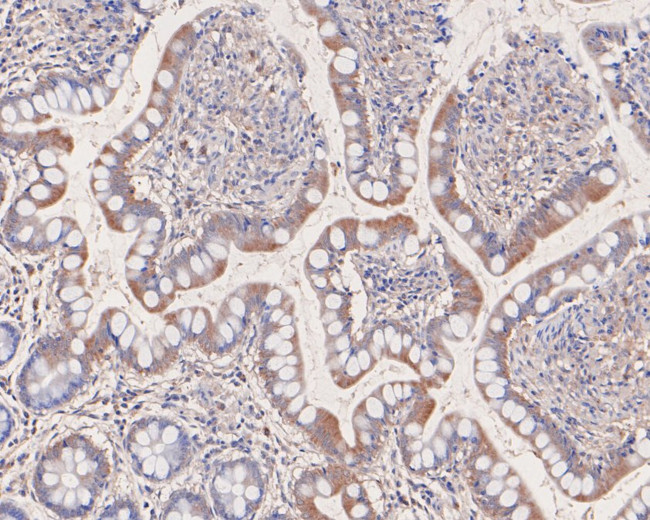 EDG2 Antibody in Immunohistochemistry (Paraffin) (IHC (P))