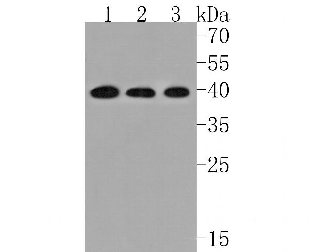 EDG2 Antibody in Western Blot (WB)