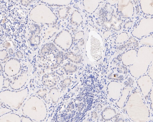 PIAS1 Antibody in Immunohistochemistry (Paraffin) (IHC (P))