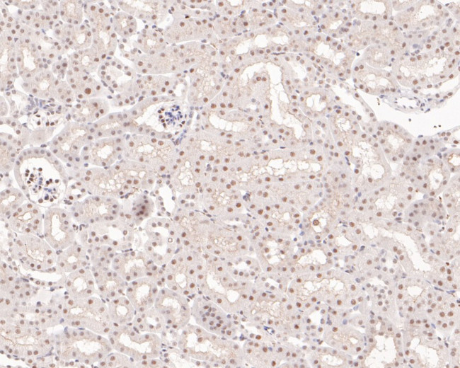 PIAS1 Antibody in Immunohistochemistry (Paraffin) (IHC (P))