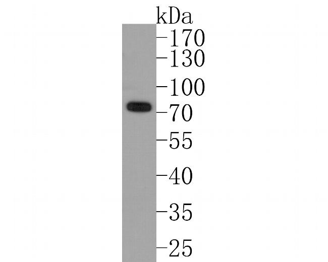 PIAS1 Antibody in Western Blot (WB)