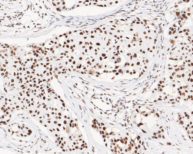 USP39 Antibody in Immunohistochemistry (Paraffin) (IHC (P))