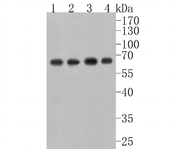 USP39 Antibody in Western Blot (WB)