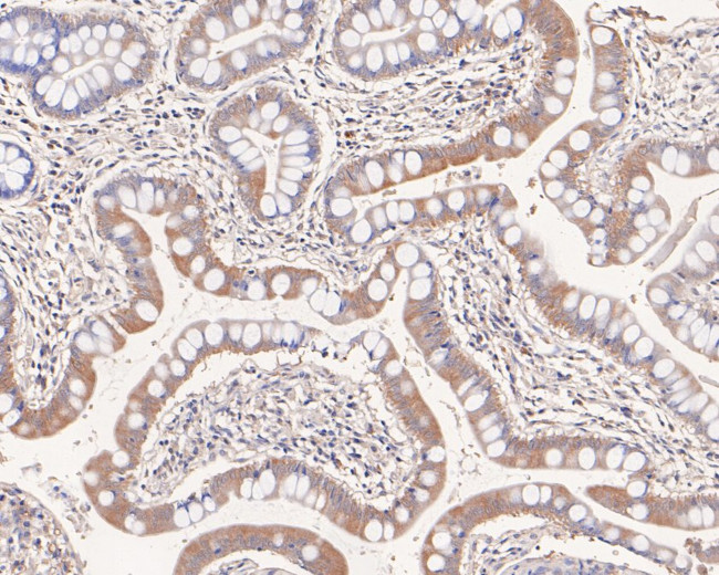 NKp44 Antibody in Immunohistochemistry (Paraffin) (IHC (P))