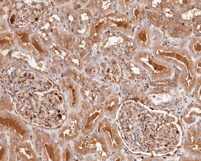 CAP1 Antibody in Immunohistochemistry (Paraffin) (IHC (P))