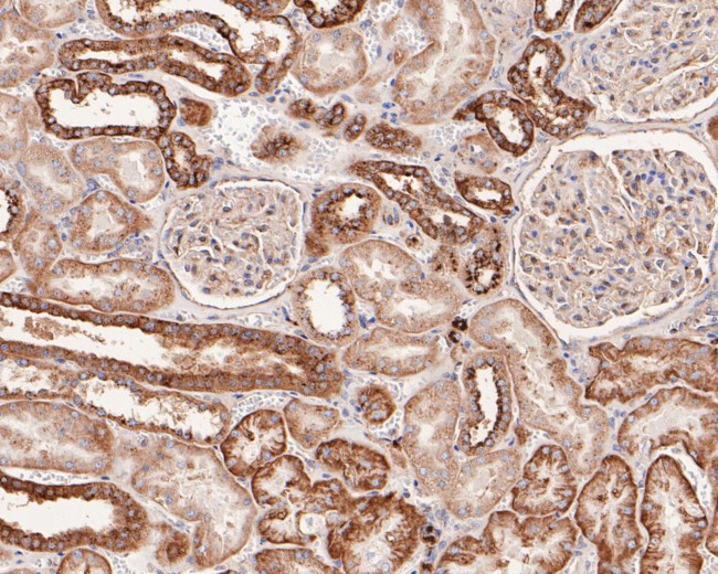 NDRG3 Antibody in Immunohistochemistry (Paraffin) (IHC (P))