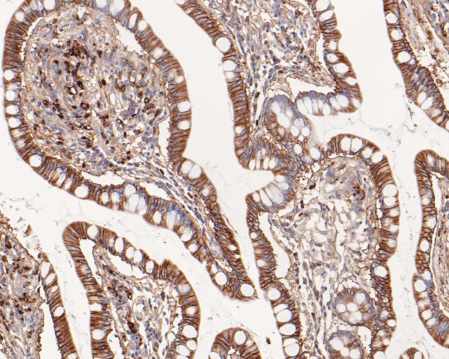 NDRG3 Antibody in Immunohistochemistry (Paraffin) (IHC (P))