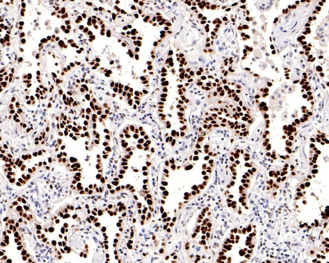 Nkx2.1 Antibody in Immunohistochemistry (Paraffin) (IHC (P))