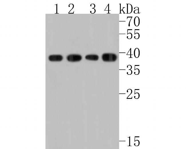 DCAF7 Antibody in Western Blot (WB)