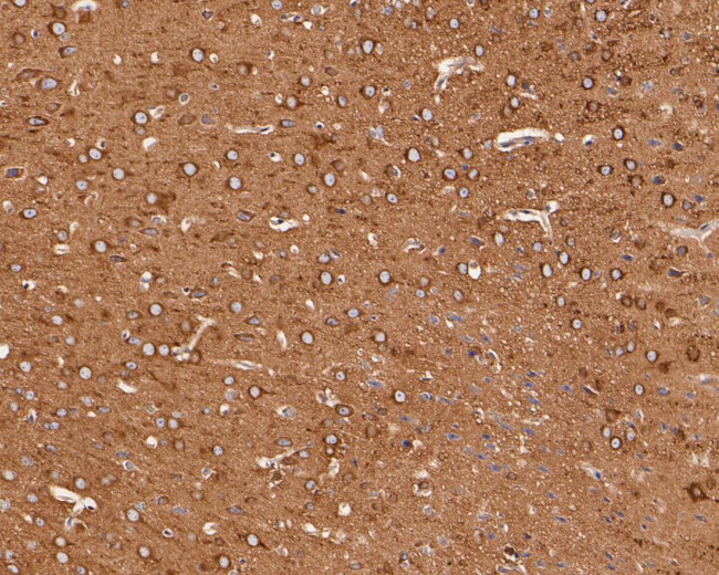 NPY5R Antibody in Immunohistochemistry (Paraffin) (IHC (P))