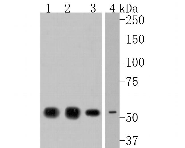 NPY5R Antibody in Western Blot (WB)