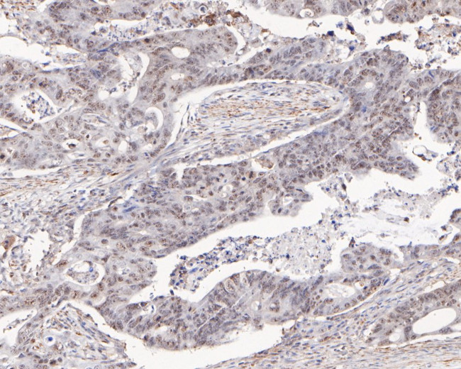 NOLA3 Antibody in Immunohistochemistry (Paraffin) (IHC (P))