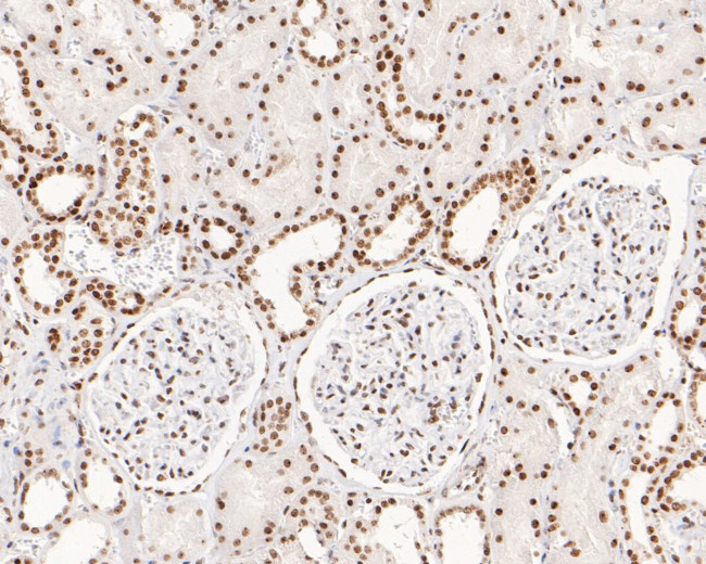 NOLA3 Antibody in Immunohistochemistry (Paraffin) (IHC (P))