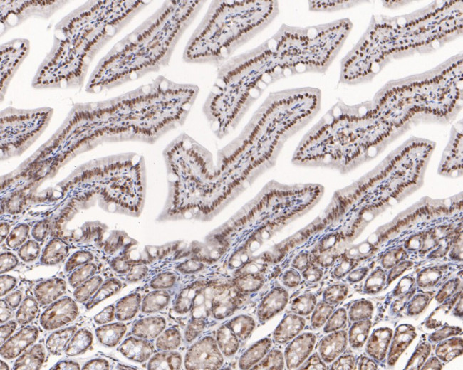 NOLA3 Antibody in Immunohistochemistry (Paraffin) (IHC (P))