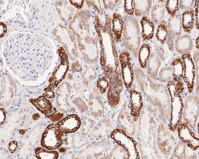 SAMM50 Antibody in Immunohistochemistry (Paraffin) (IHC (P))