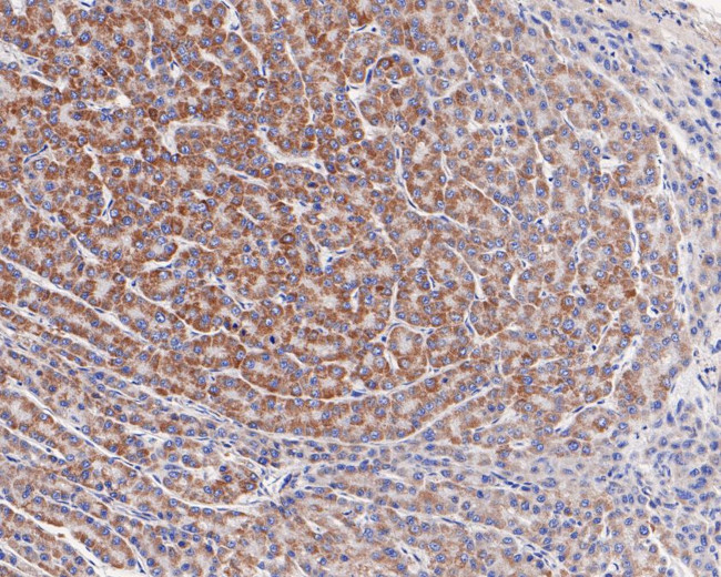 SAMM50 Antibody in Immunohistochemistry (Paraffin) (IHC (P))