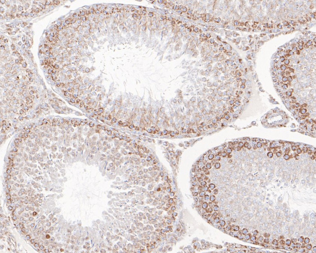 SAMM50 Antibody in Immunohistochemistry (Paraffin) (IHC (P))