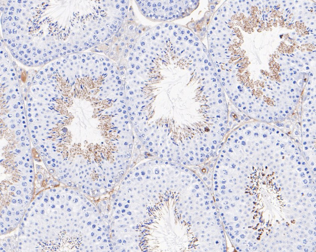 MC5R Antibody in Immunohistochemistry (Paraffin) (IHC (P))